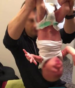 Outrage over chiropractor’s treatment of baby
