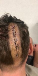 Liam leaps another hurdle